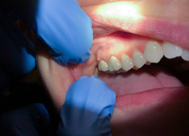 Best Cosmetic Emergency Dentistry in Moss Bluff, LA